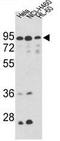 HMP antibody, GTX81949, GeneTex, Western Blot image 