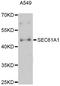 SEC61 Translocon Alpha 1 Subunit antibody, abx126523, Abbexa, Western Blot image 