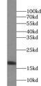 Ubiquitin Conjugating Enzyme E2 D4 (Putative) antibody, FNab09169, FineTest, Western Blot image 
