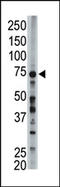 Long-chain-fatty-acid--CoA ligase 6 antibody, AP12265PU-N, Origene, Western Blot image 