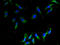 CKLF Like MARVEL Transmembrane Domain Containing 2 antibody, A58602-100, Epigentek, Immunofluorescence image 