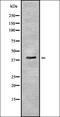 Pygopus Family PHD Finger 2 antibody, orb337041, Biorbyt, Western Blot image 