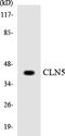 Ceroid-lipofuscinosis neuronal protein 5 antibody, LS-C291813, Lifespan Biosciences, Western Blot image 