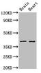 Ceramide Synthase 1 antibody, LS-C674075, Lifespan Biosciences, Western Blot image 