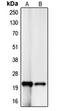 p21 antibody, orb213714, Biorbyt, Western Blot image 