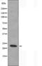 Mitochondrial Ribosomal Protein L20 antibody, orb226196, Biorbyt, Western Blot image 