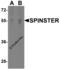 Sphingolipid Transporter 1 (Putative) antibody, 7651, ProSci, Western Blot image 