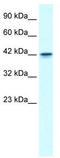 Growth Factor Independent 1B Transcriptional Repressor antibody, TA329111, Origene, Western Blot image 