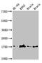 Ubiquitin Conjugating Enzyme E2 V2 antibody, CSB-PA025484DA01HU, Cusabio, Western Blot image 