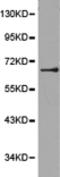 Glutamate Decarboxylase 2 antibody, TA323559, Origene, Western Blot image 