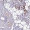 Chromosome 11 Open Reading Frame 91 antibody, HPA050487, Atlas Antibodies, Immunohistochemistry paraffin image 