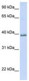 Tetraspanin 10 antibody, TA339592, Origene, Western Blot image 