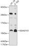 PCNA Clamp Associated Factor antibody, 13-599, ProSci, Western Blot image 