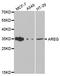 Amphiregulin antibody, MBS127865, MyBioSource, Western Blot image 
