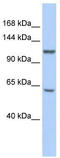 DNA replication licensing factor MCM8 antibody, TA341691, Origene, Western Blot image 
