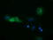 DHEA-ST antibody, LS-C115618, Lifespan Biosciences, Immunofluorescence image 