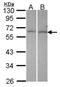 Dual Specificity Phosphatase 10 antibody, NBP2-16235, Novus Biologicals, Western Blot image 