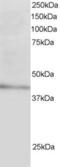 Low Density Lipoprotein Receptor Adaptor Protein 1 antibody, LS-C20125, Lifespan Biosciences, Western Blot image 