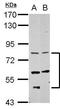 Coiled-Coil Domain Containing 114 antibody, PA5-32115, Invitrogen Antibodies, Western Blot image 