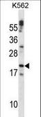 Cardiotrophin-1 antibody, LS-C167126, Lifespan Biosciences, Western Blot image 