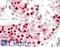 Tumor Protein P53 Binding Protein 1 antibody, LS-B13416, Lifespan Biosciences, Immunohistochemistry paraffin image 