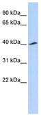 Potassium Voltage-Gated Channel Subfamily J Member 16 antibody, TA338586, Origene, Western Blot image 