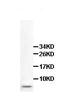 Hod antibody, ab106251, Abcam, Western Blot image 