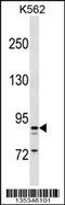 Taste 1 Receptor Member 3 antibody, 58-438, ProSci, Western Blot image 