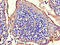 RAD54 Homolog B antibody, orb46623, Biorbyt, Immunohistochemistry paraffin image 