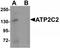 ATPase Secretory Pathway Ca2+ Transporting 2 antibody, TA319799, Origene, Western Blot image 