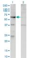 Rho guanine nucleotide exchange factor 5 antibody, H00007984-M02, Novus Biologicals, Western Blot image 