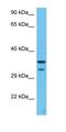 SWI/SNF-related matrix-associated actin-dependent regulator of chromatin subfamily E member 1-related antibody, orb327240, Biorbyt, Western Blot image 