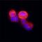 Alpha-1,6-Mannosylglycoprotein 6-Beta-N-Acetylglucosaminyltransferase antibody, MAB5469, R&D Systems, Immunocytochemistry image 