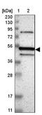 CUGBP Elav-Like Family Member 3 antibody, NBP1-89933, Novus Biologicals, Western Blot image 