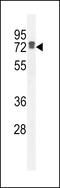 Leucine Rich Repeat Containing 40 antibody, 55-569, ProSci, Western Blot image 