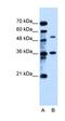 Transmembrane Protein 8B antibody, orb324973, Biorbyt, Western Blot image 
