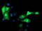 Microtubule-associated protein RP/EB family member 2 antibody, MA5-25535, Invitrogen Antibodies, Immunocytochemistry image 