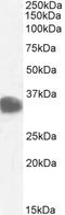 Carbonyl Reductase 1 antibody, PA5-18070, Invitrogen Antibodies, Western Blot image 