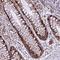 Armadillo Repeat Containing X-Linked 6 antibody, HPA043030, Atlas Antibodies, Immunohistochemistry paraffin image 