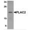 Placenta-specific protein 2 antibody, MBS151020, MyBioSource, Western Blot image 