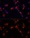 Eukaryotic Translation Elongation Factor 1 Gamma antibody, GTX32572, GeneTex, Immunofluorescence image 