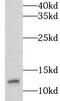 LSM7 Homolog, U6 Small Nuclear RNA And MRNA Degradation Associated antibody, FNab04877, FineTest, Western Blot image 