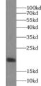 CLDN4 antibody, FNab01739, FineTest, Western Blot image 