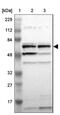 Phosphoenolpyruvate carboxylase antibody, NBP1-80928, Novus Biologicals, Western Blot image 