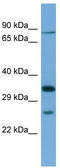 Sodium- and chloride-dependent glycine transporter 1 antibody, TA329523, Origene, Western Blot image 