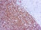 Replication Protein A2 antibody, GTX22175, GeneTex, Immunohistochemistry paraffin image 