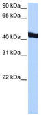 General Transcription Factor IIA Subunit 1 Like antibody, TA339816, Origene, Western Blot image 