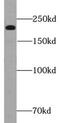 Myosin-7 antibody, FNab05478, FineTest, Western Blot image 