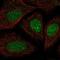 Synaptonemal Complex Central Element Protein 2 antibody, NBP2-57063, Novus Biologicals, Immunofluorescence image 