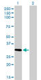Zinc Finger Protein 124 antibody, LS-C198475, Lifespan Biosciences, Western Blot image 